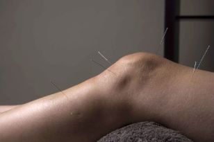 A acupuntura promove a reparación do tecido articular