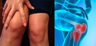 O malestar e o inchazo na zona do xeonllo son os primeiros síntomas da artrose